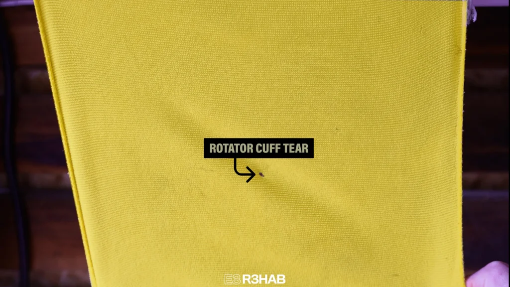 실제 파열의 의미