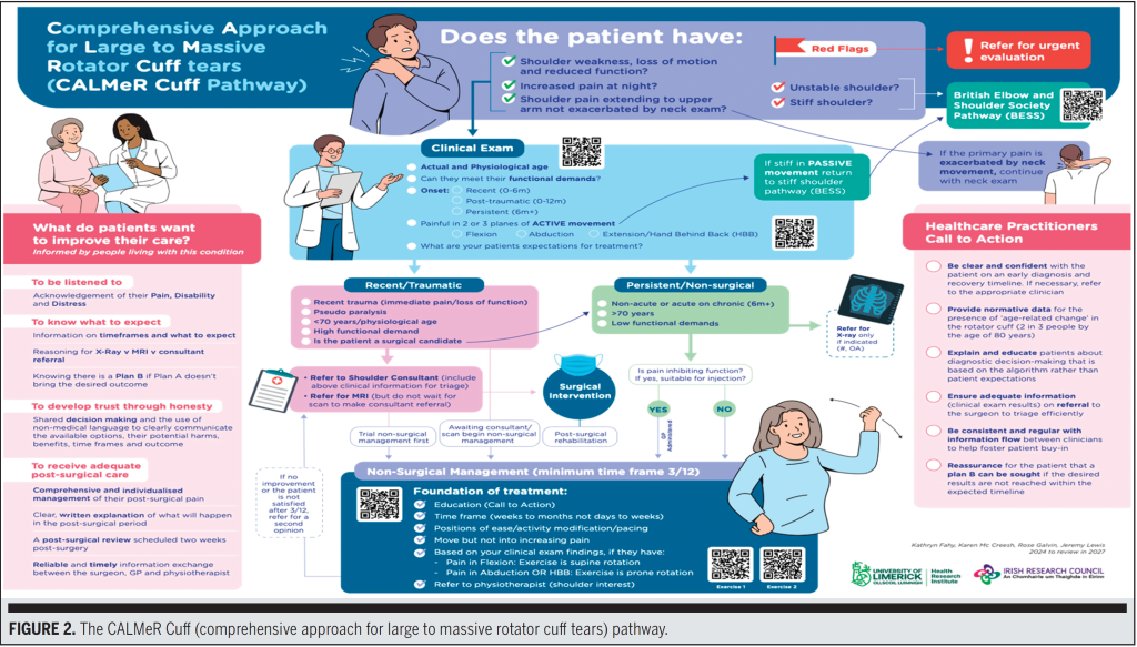 광범위 회전근개 파열 수술 결정 알고리즘