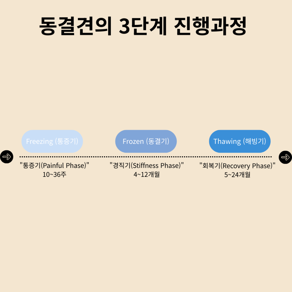 오십견 회복기간
