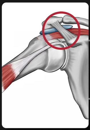 어깨 충돌증후군 생리