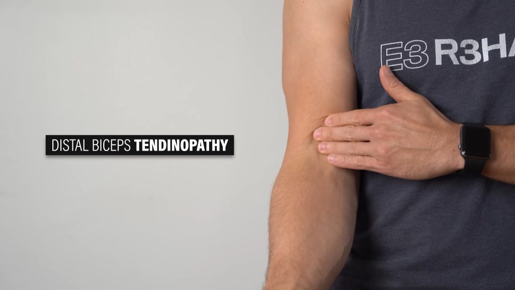 팔꿈치 통증원인 이두근 