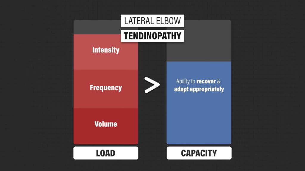 테니스 엘보 재활 부하
