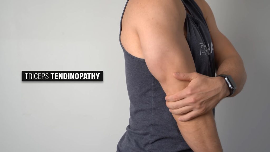 triceps tendinopathy