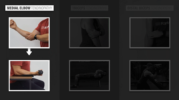 각종 건염 운동