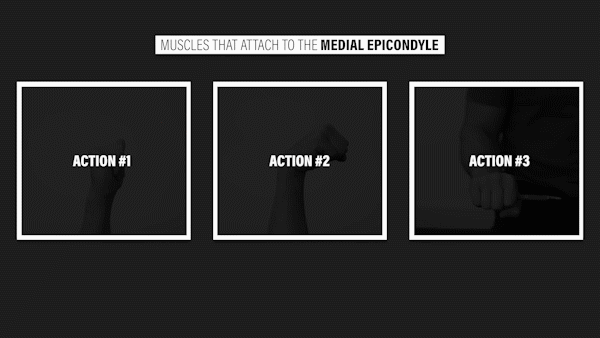 팔꿈치 통증원인 내측상과 근육운동