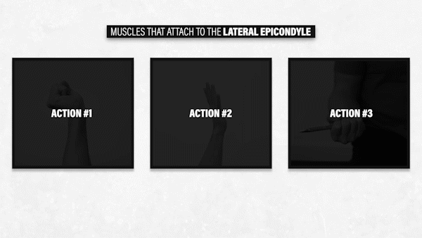 팔꿈치 통증원인 외측상과 근육운동